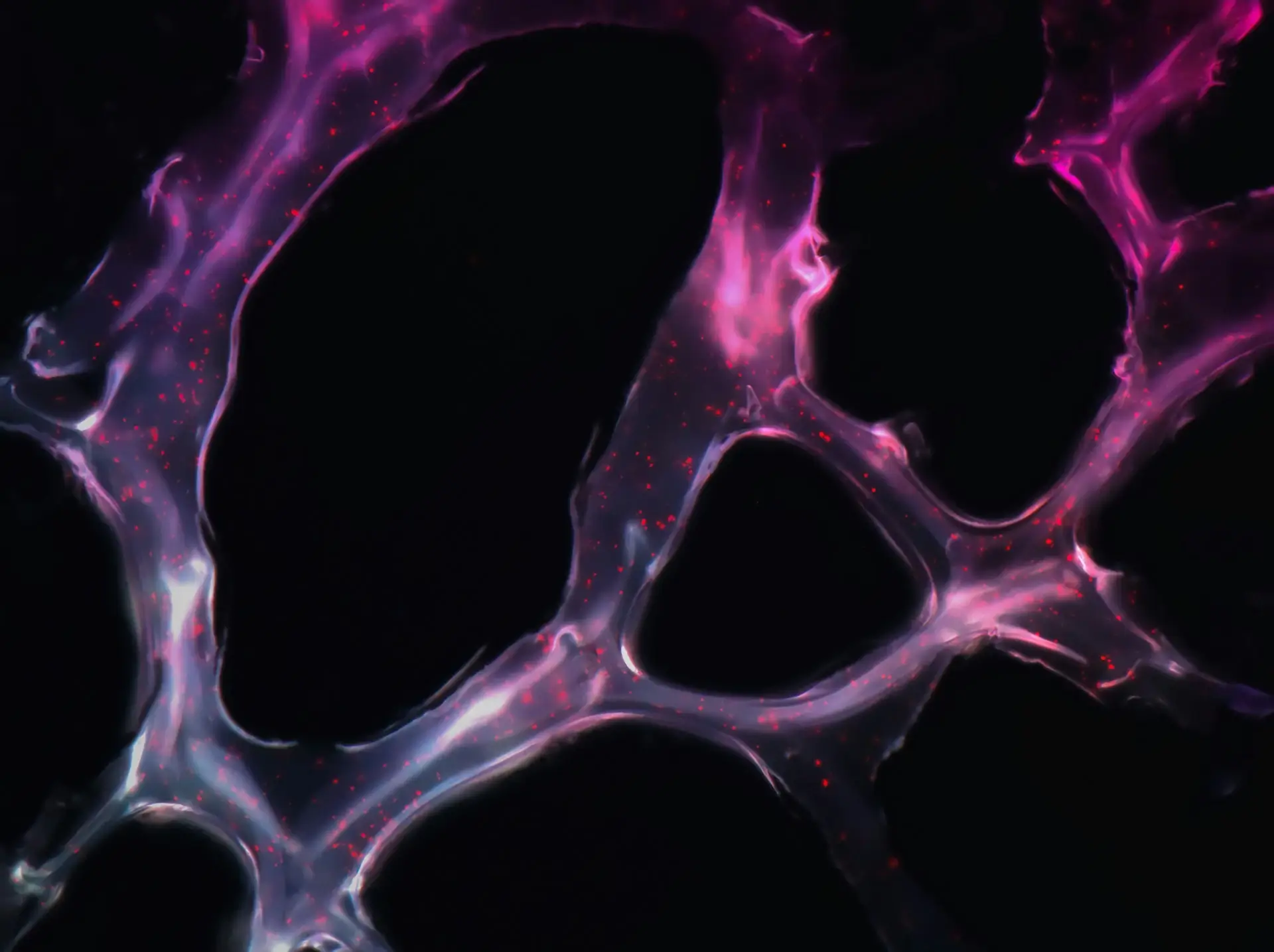 Markery nowotworowe – cena, co to za badania?